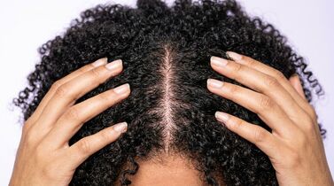0e775370_pdrn_no_cabelo_img2.jpg