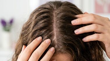 Mulher com cabelo ondulado examinando o couro cabeludo